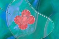 甲减去深圳做三代试管麻烦吗？需要花费多少钱？